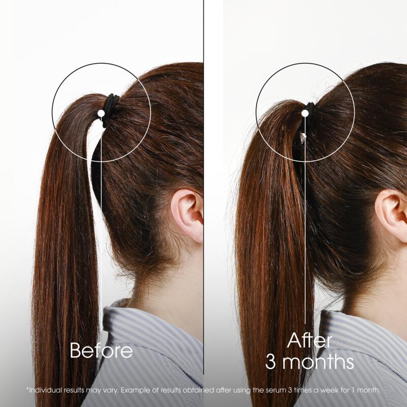 ANTI-HAIR LOSS intense strengthening Serum with Quinine