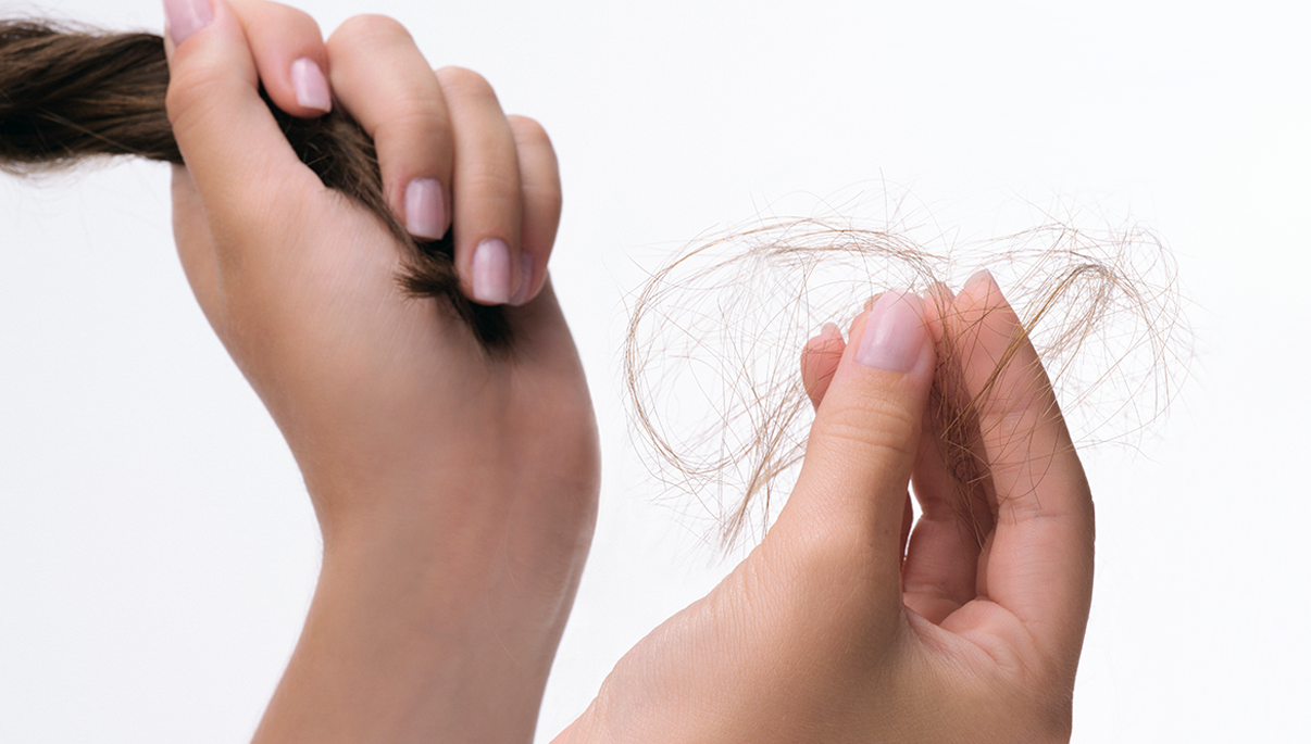 DU_ANAPHASE_SILO_HAIR-LOSS_BANNER-DESKTOP