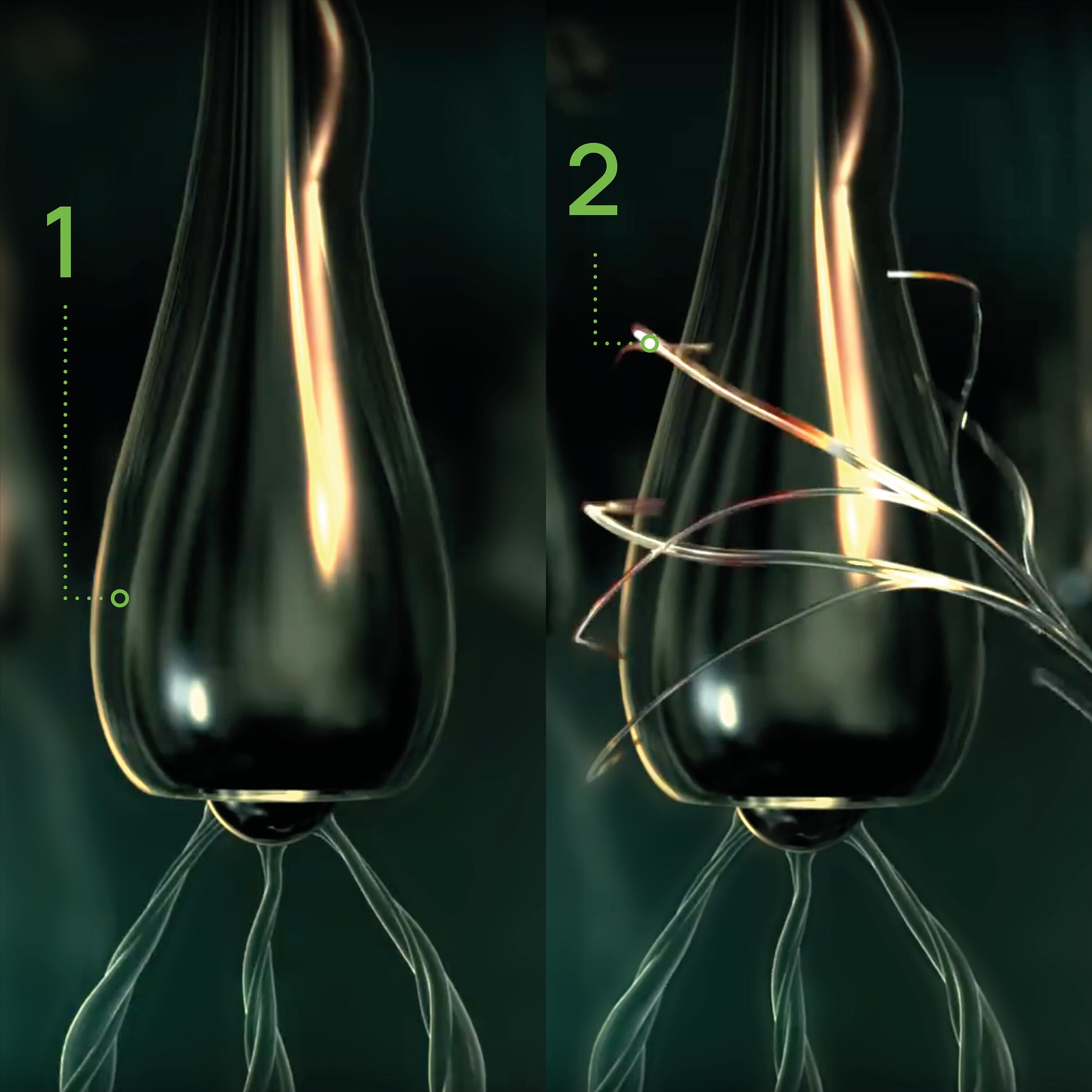 RF_Triphasic_Inflammation-bulbe-capillaire_Website__24-jpg