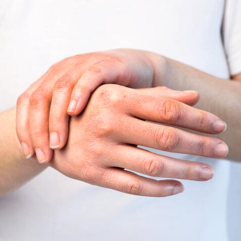 Linderung von Ekzemen an den Händen