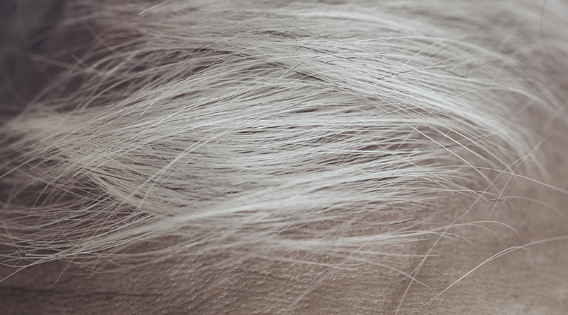 RF_website_expert-dossier-gray-hair_why-gray-hair_what-is-a-gray-hair_804x446