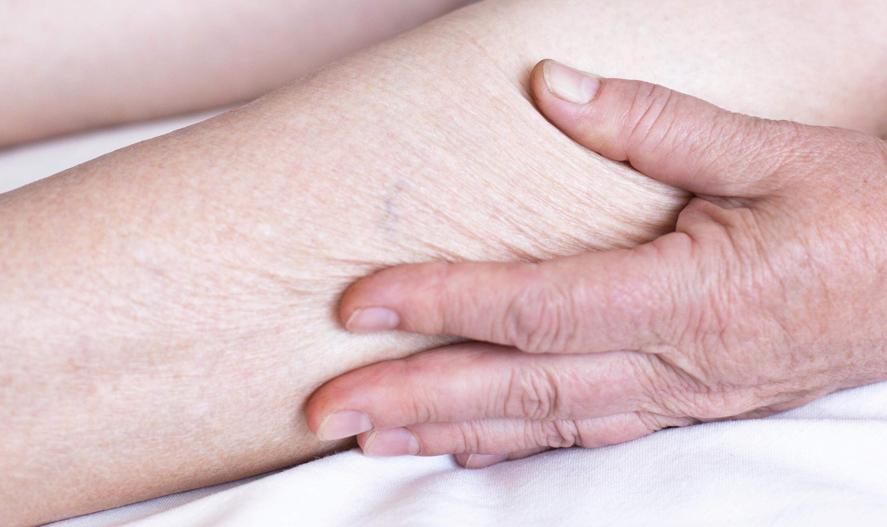 md_dexeryl_website-senile-xerosis-image_adobestock_323693884