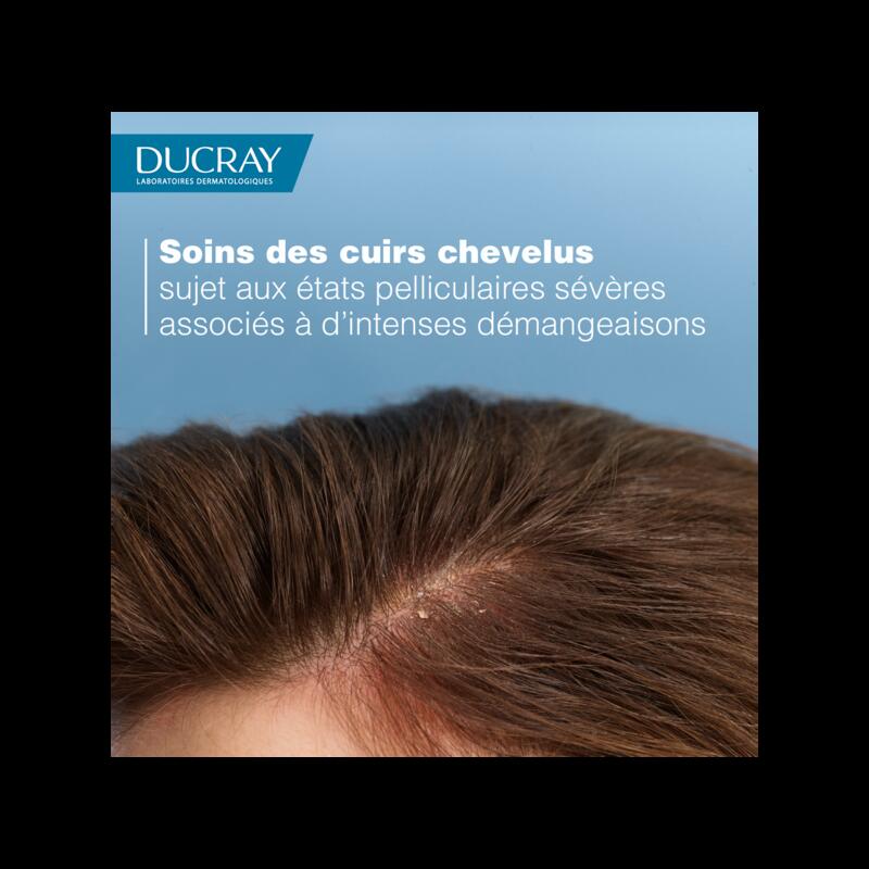 Shampooing traitant - Ciclopiroxolamine 1,5%