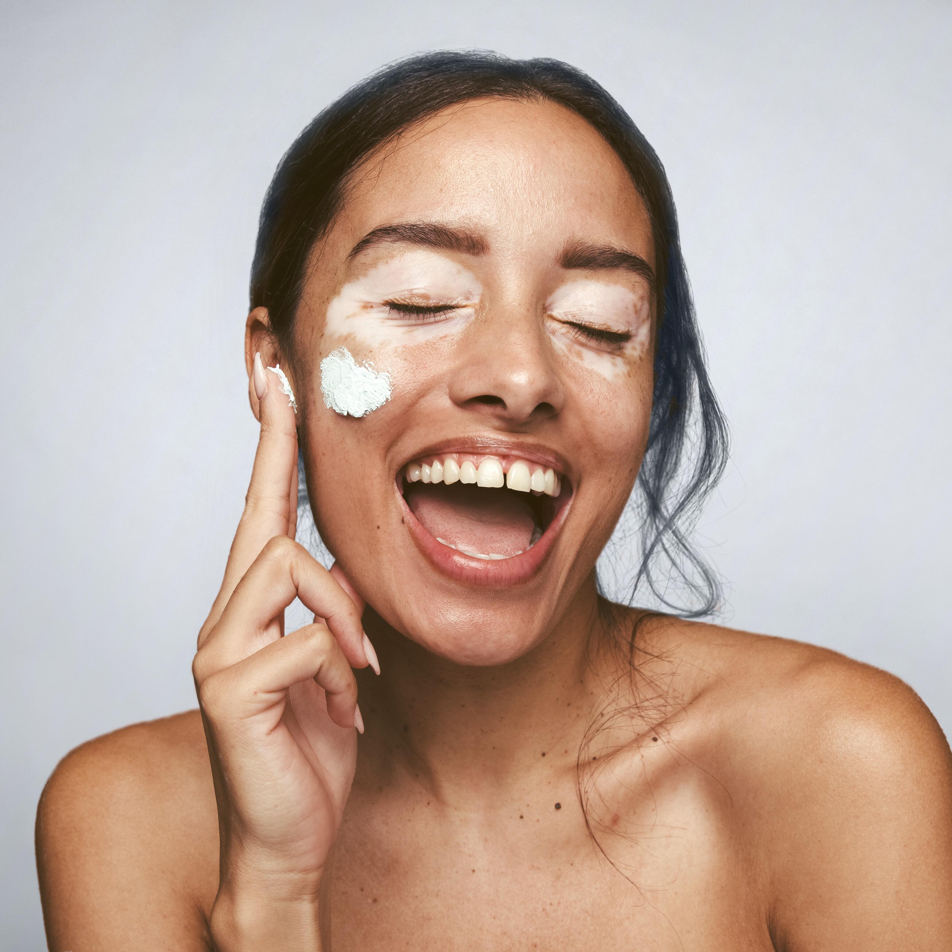 av_maquillage_femme_vitiligo_creme_1x1
