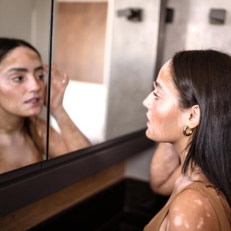 av_maquillage_femme_vitiligo_1x1 472x472