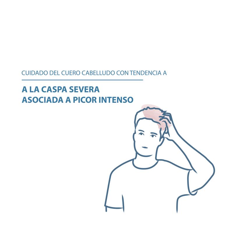 Shampoo tratamiento caspa severa