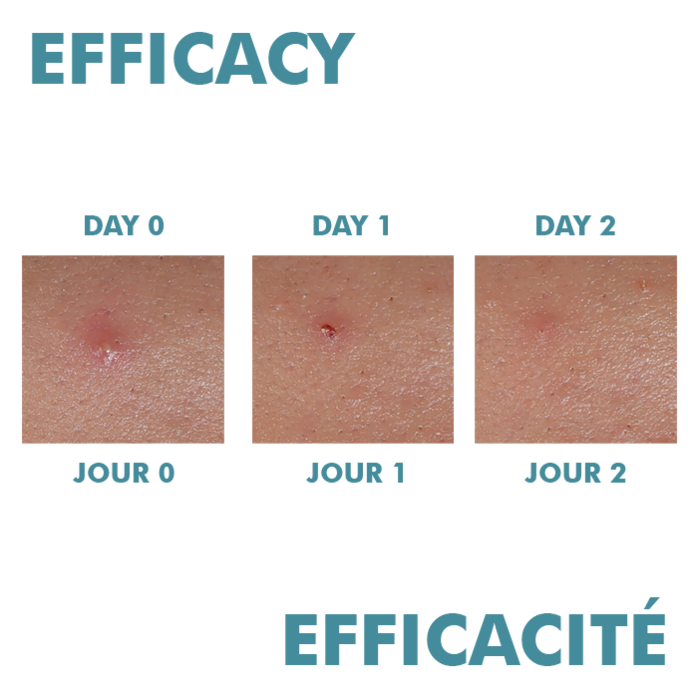 Resultados Comedomed Spot