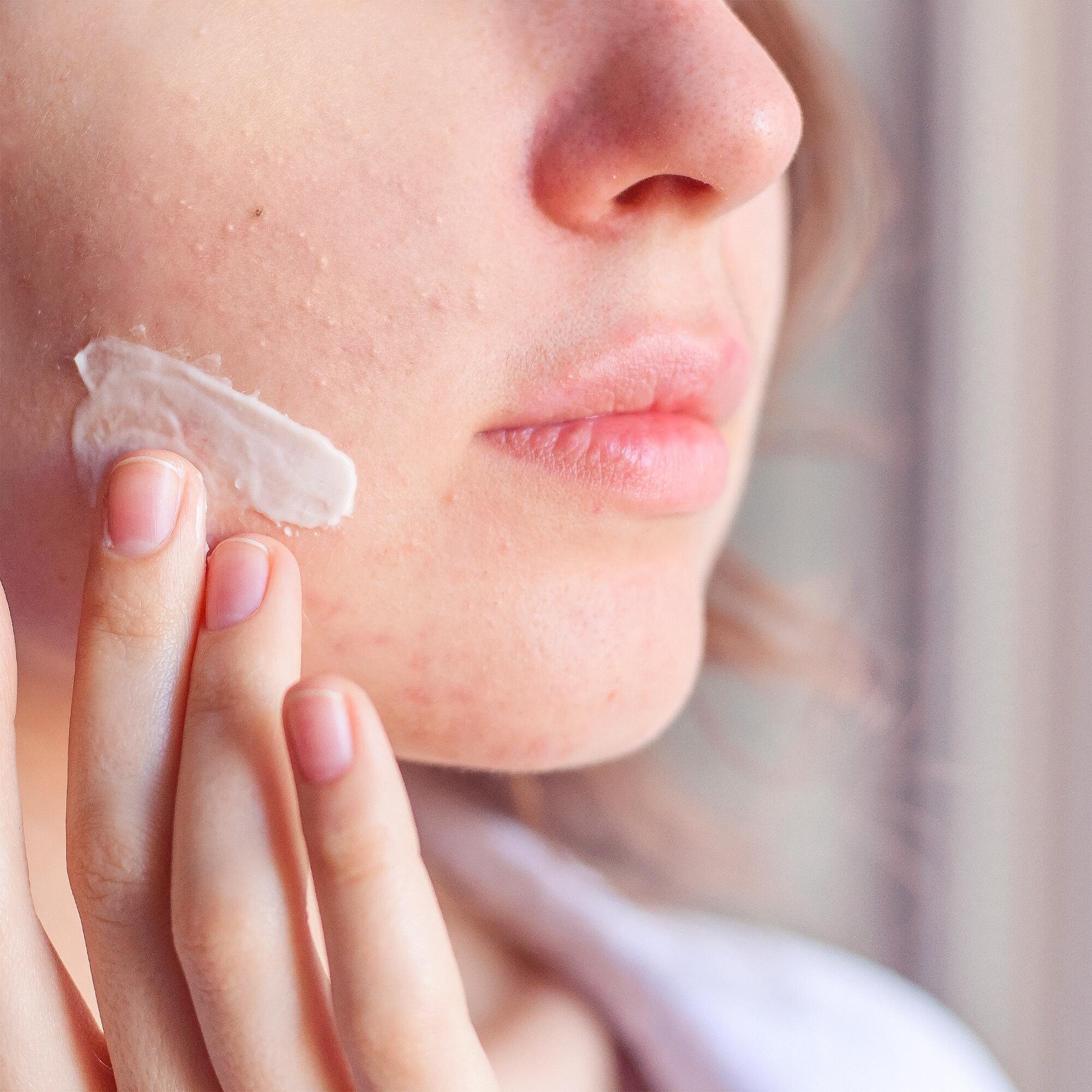 <span class="ezstring-field">av_acne_retentionnelle_creme_visage_1x1</span>