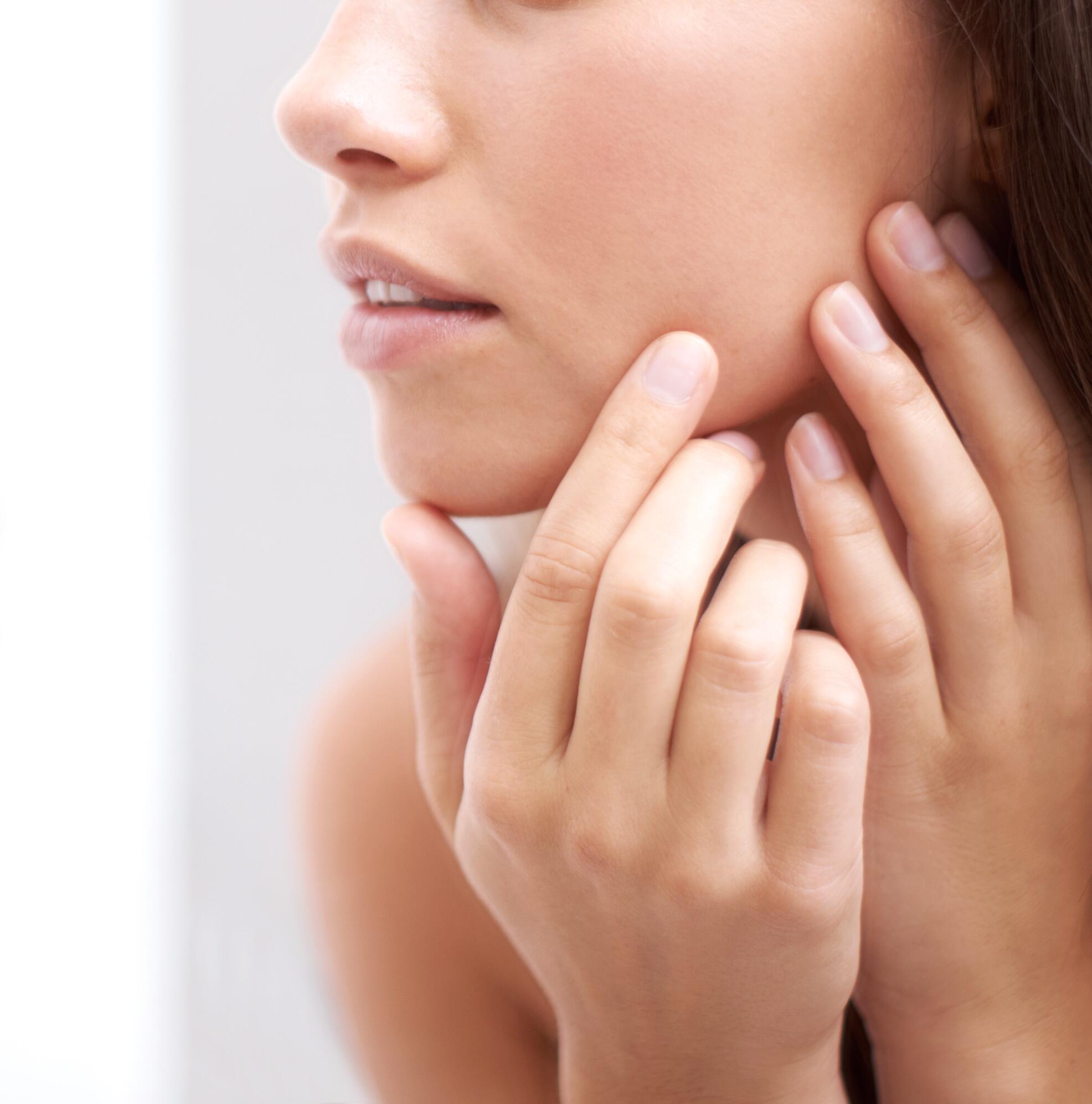 Inflammatory acne
