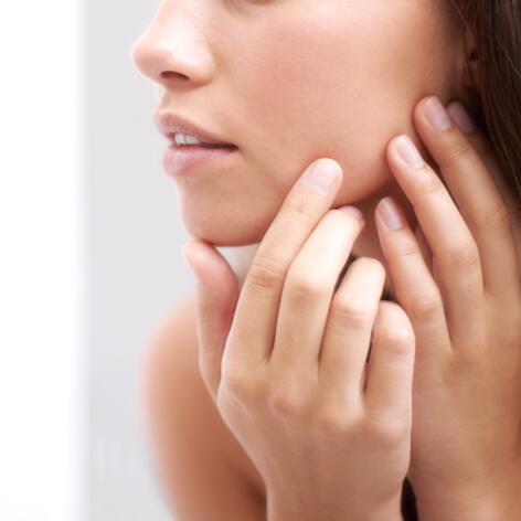 L’acné inflammatoire