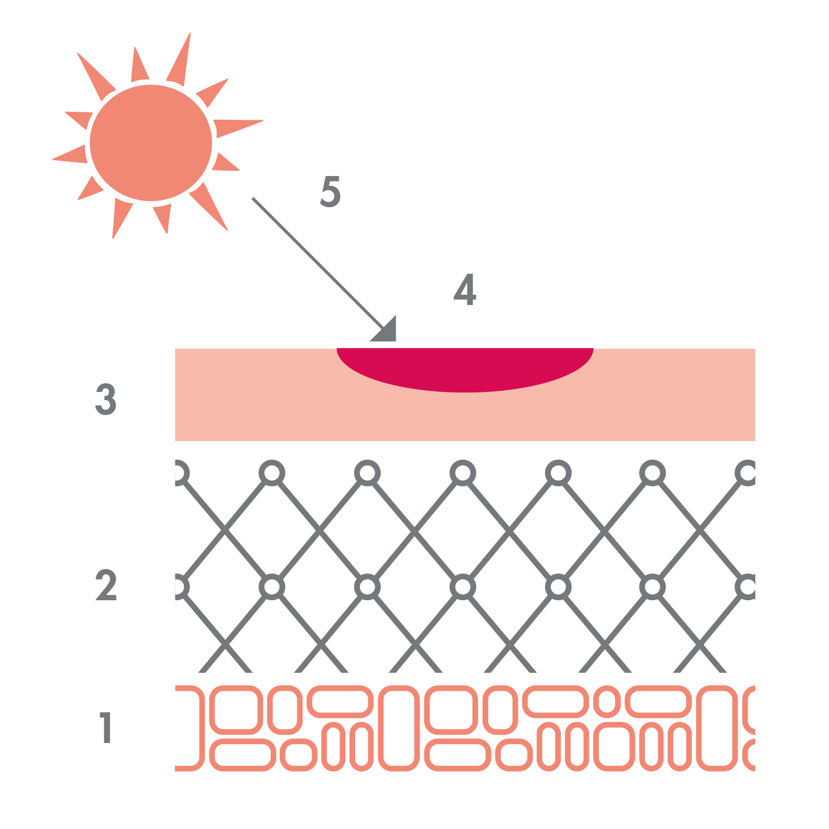 av_acne_schema_photosensibilisation_1x1
